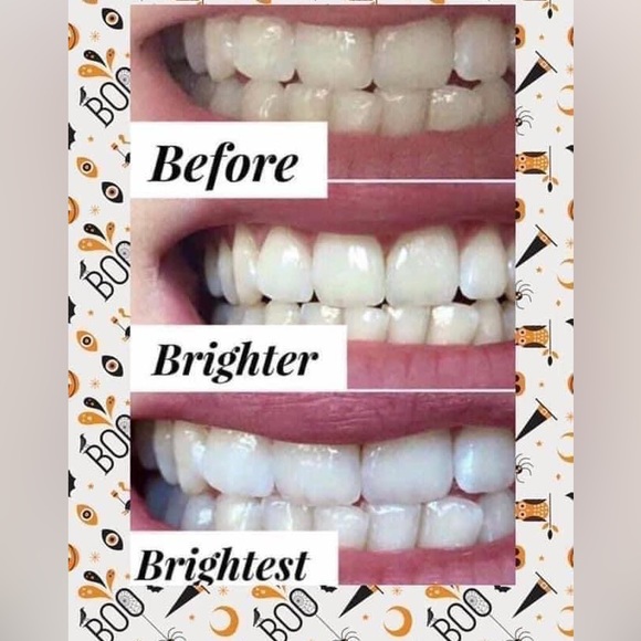 Whitening Toothpaste - Picture 5 of 5